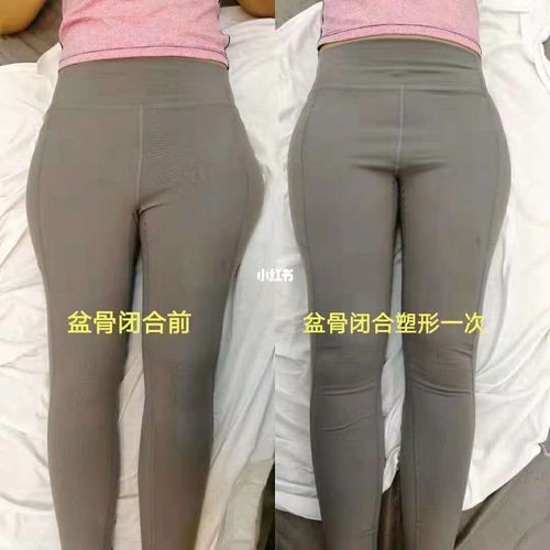 新澳門開獎記錄新紀(jì)錄和女性盆骨正在縮小與女性盆骨正在縮小怎么回事