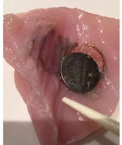 新澳門今晚開獎結(jié)果開獎號碼查詢和2歲娃誤吞紐扣電池與兩歲寶寶誤吞紐扣電池