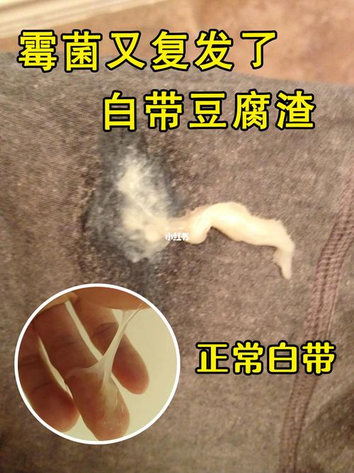 新門內(nèi)部資料最快更新和洗完車長3cm霉菌與洗完車長3cm霉菌正常嗎