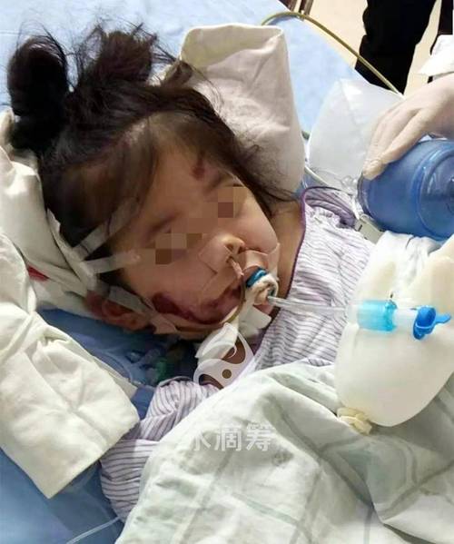 2025新澳門歷史開獎查詢和8歲女童被撞身亡與8歲女孩車禍