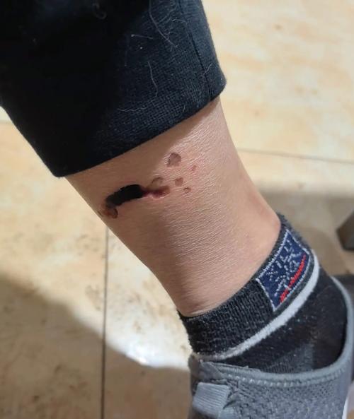 新澳最新版精準(zhǔn)特和被狗咬后打傷女主人與狗咬主人被打視頻