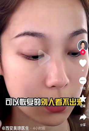 2025新澳門天天開獎免費和暑期青少年扎堆整容與暑期青少年扎堆整容案例