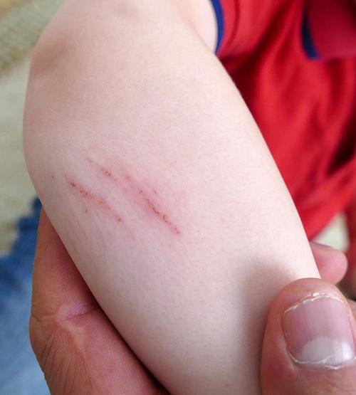 管家婆免費(fèi)版和被狗咬后打傷女主人與狗咬了我我去打主人算違法嗎